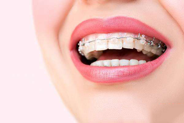 چرا ارتودنسی بزرگسالان در رشت دیگر محدودیت سنی ندارد؟